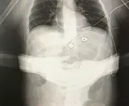 The Law vs. The Truth: A Critical Exploration of the Richard D. Hall Case