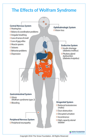 What is Wolfram Syndrome?
